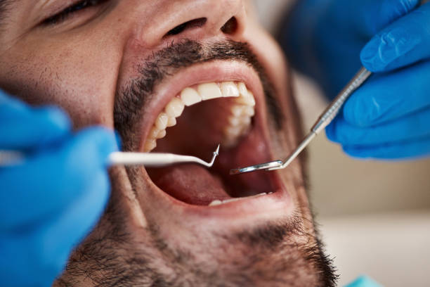 Best Emergency Dental Care for Trauma or Injury in Spring City, PA